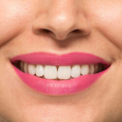 Rossetto Matte – Cabaret 164 Nee